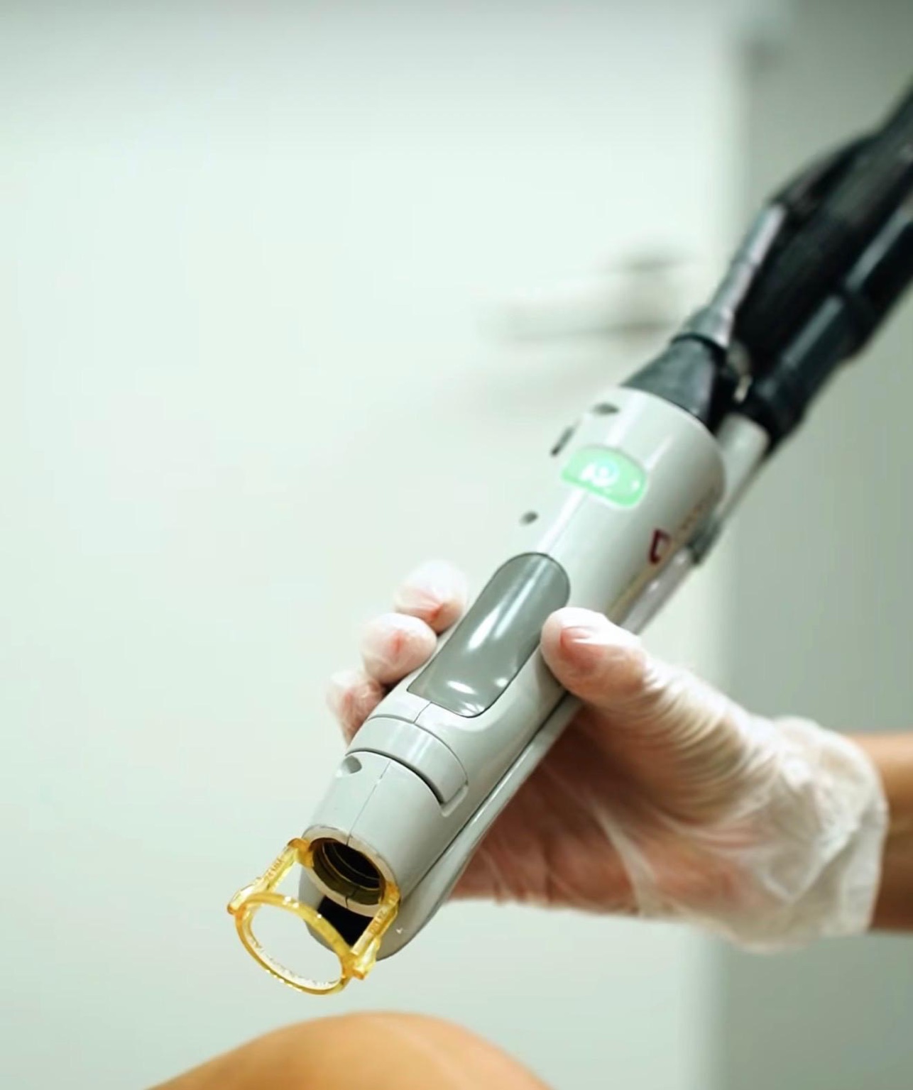 Peça de mão utilizada na depilação laser