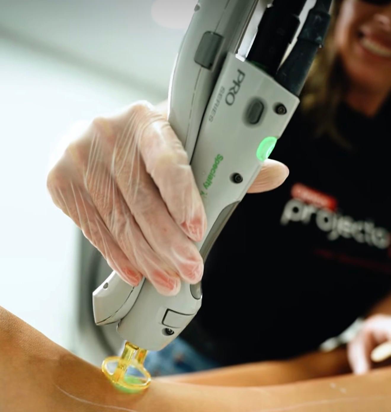 Aplicação profissional de depilação laser